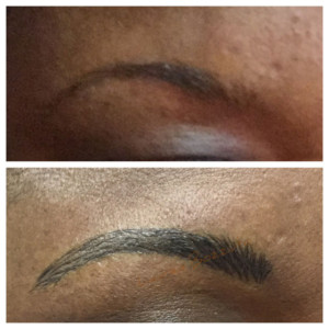 Eyebrow Correction - before and after